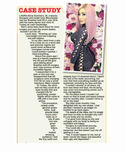 BAAPSMedia's tweet photo. #PlasticSurgeon & BAAPS member @ReflectClinicCo quoted in @Daily_Star feature on the #BBL Surgery U.K. surgeons warned against at #BAAPS2018 https://t.co/otwlPzcCv1