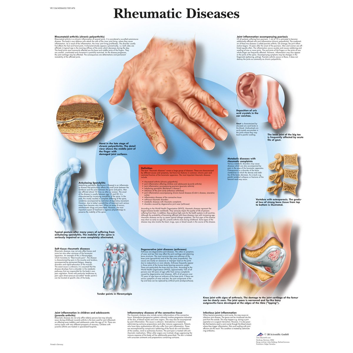 Butler Rheumatology Rheumatology Journal (@Rheumatology_J) / Posts / X