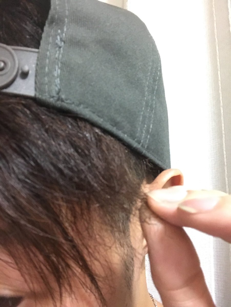 ちょる男 今日doux行ってパーマ当てたら前髪ちんげ以上にチリチリになってた笑笑