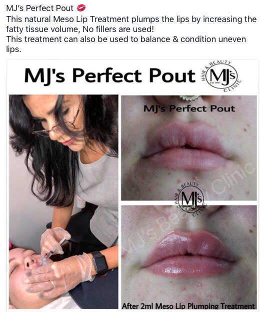 MJ's Perfect Pout💋
#Royton #mjsbeautyclinic #manchester #hydration #kissablelips #lipplumping #mesotherapy #meso #mjsperfectpout #beautyclinic #beautysalon #fusion #condition