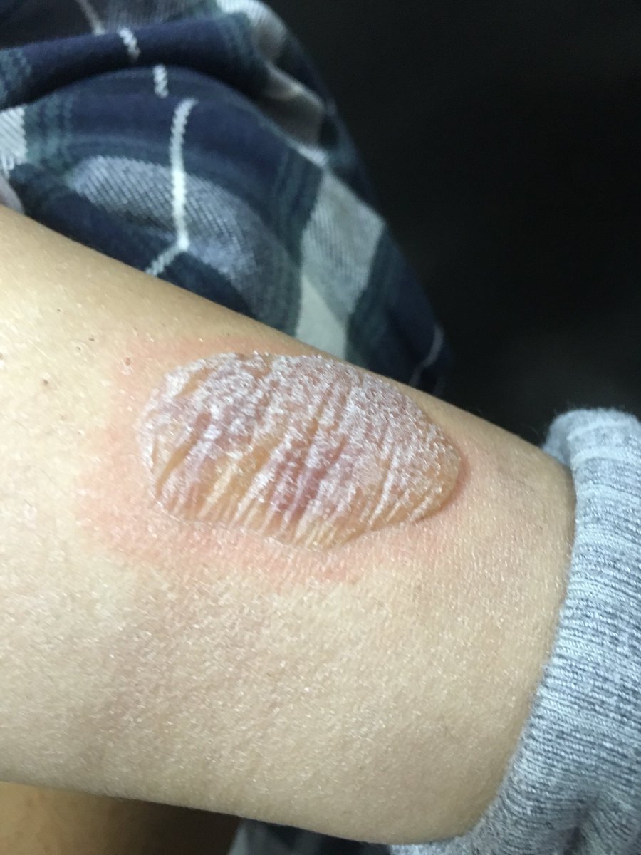 疫苗受害家属何方美（侠女十三妹）及丈夫因维权被迫害中 tweet media