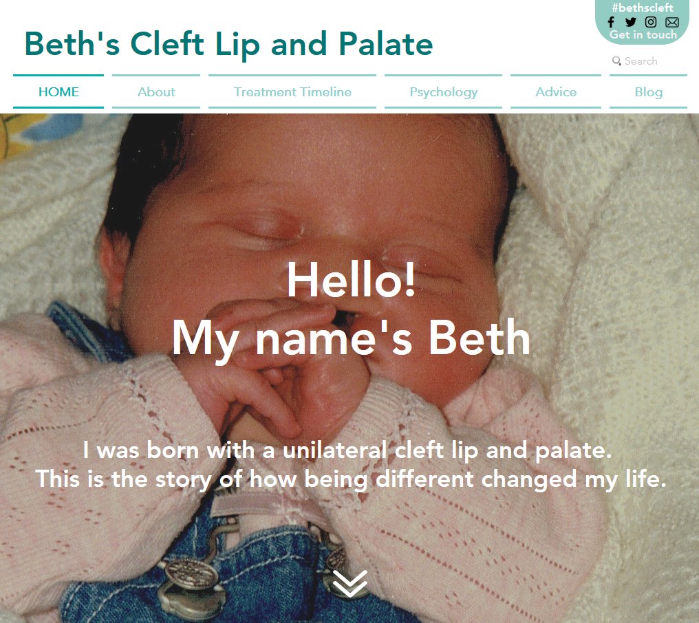 Can't believe it's a year ago that I launched my website bethscleft.com! It's been incredible, and it's amazing that a year later, the site is the reason I am in my #dramjob working for @smiletrainuk! Thank you so much to everyone who has supported me! #cleftlipandpalate