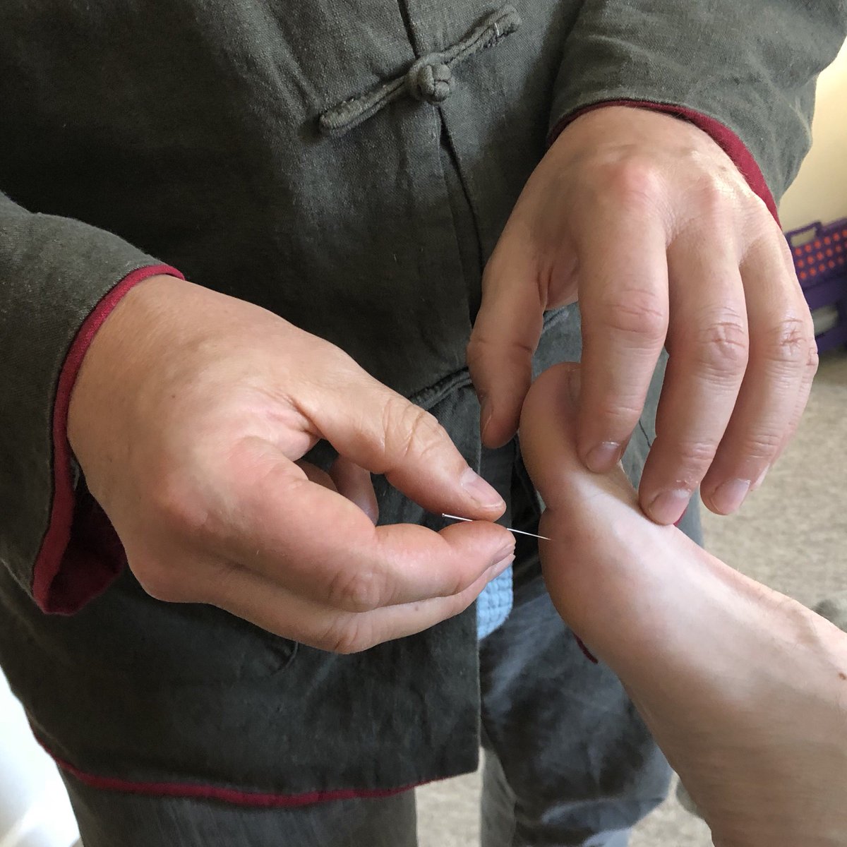 Spark_Magazine's tweet photo. #Acupuncture can cure anything... even a hangover! https://t.co/1rpkEjPPIV https://t.co/OVP6NKPchs