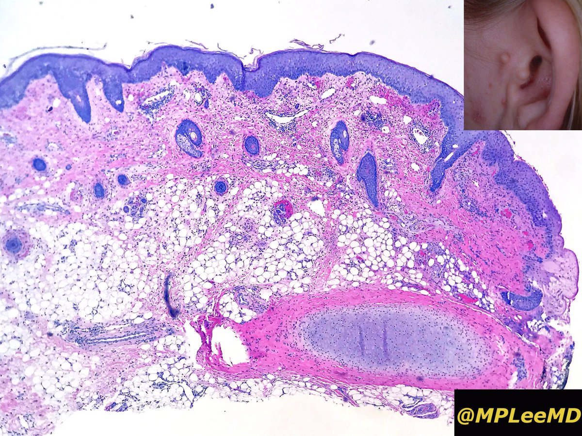 Paul Drury (SkinPathology) Twitter