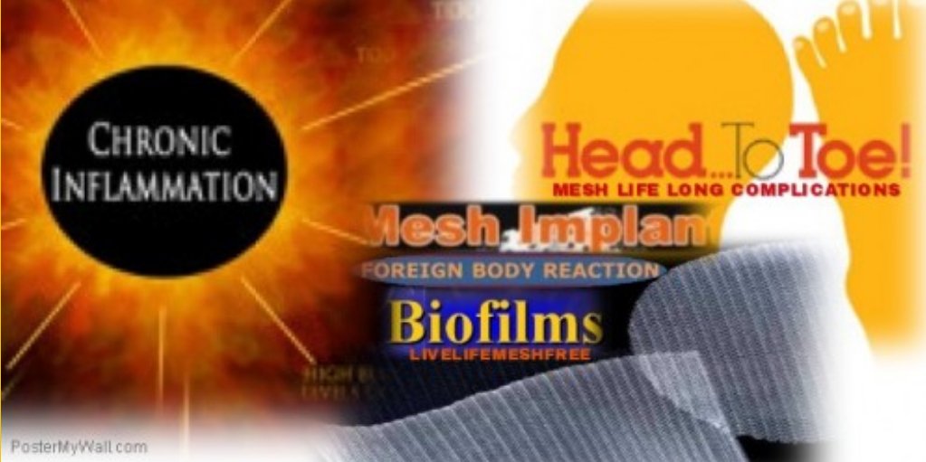 JanUrban12's tweet photo. They are enough to make you sick #biofilms attached to #Mesh #MedicalDevices can colonize anywhere in the body causing #chronicillness #Chronic #Inflammation #Infections #Diseases #Sepsis #OrganFailure and more. In other words, it turns the body into a #TortureChamber of #Horrors https://t.co/Tudf1g3WLJ