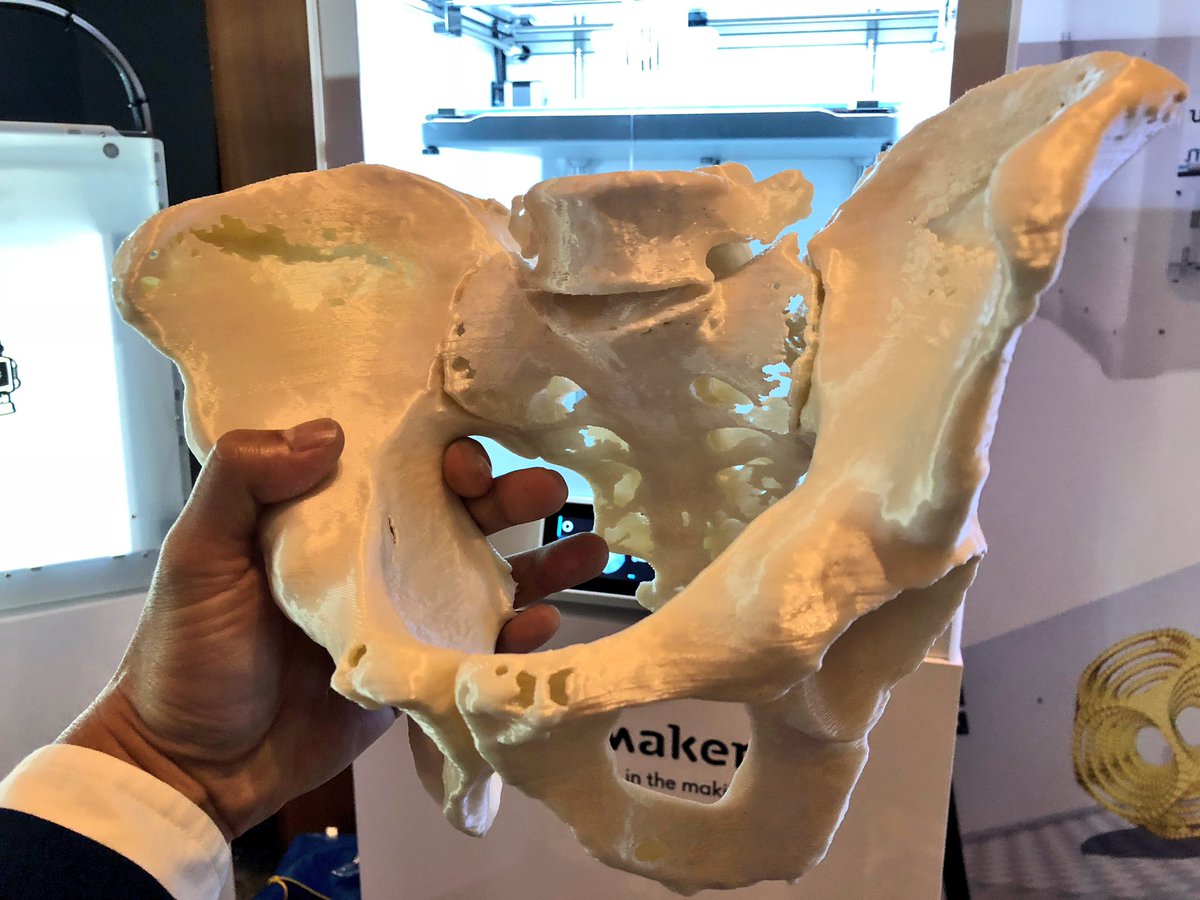 BonKu's tweet photo. This entire pelvis was 3D printed. #Construct3Dconf https://t.co/6UeDpKf28S