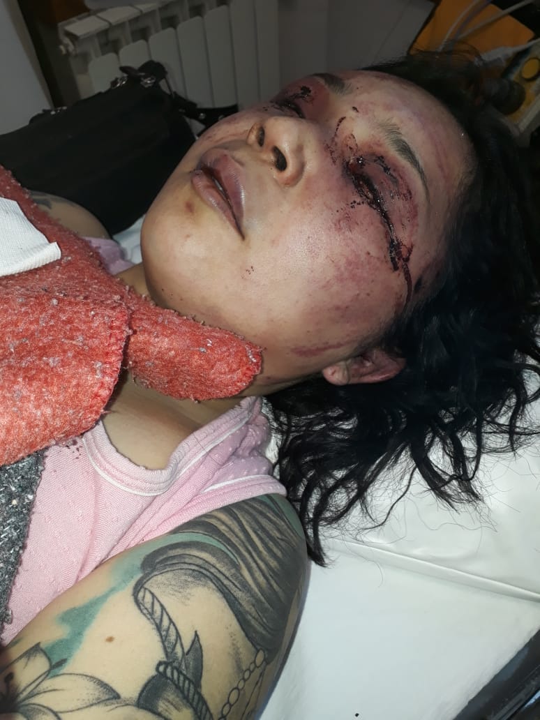 MatiBagnato's tweet photo. Lorena se contactó conmigo recién pidiendo ayuda, así la atacó su ex pareja q vive a 3 cuadras de su casa.
Me pidió hacer público su caso y estas fotos porque tiene terror q la mate.
Ojala pronto detengan a esta bestia y Lorena pueda vivir en paz. https://t.co/KMcEAvuvv1