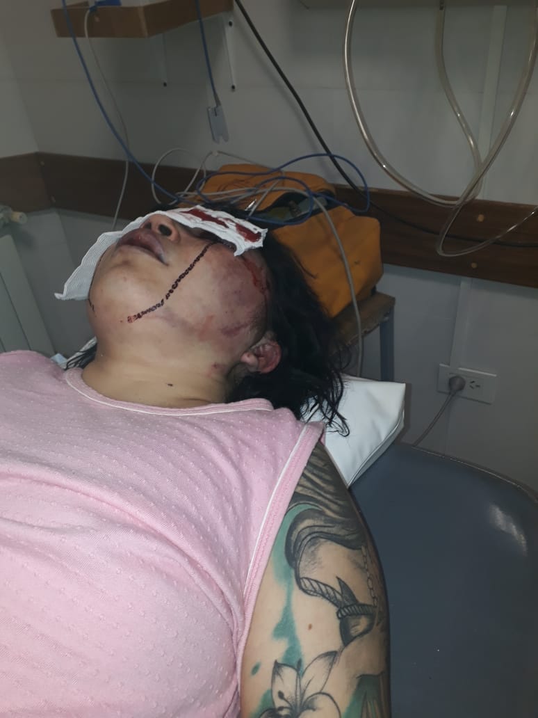 MatiBagnato's tweet photo. Lorena se contactó conmigo recién pidiendo ayuda, así la atacó su ex pareja q vive a 3 cuadras de su casa.
Me pidió hacer público su caso y estas fotos porque tiene terror q la mate.
Ojala pronto detengan a esta bestia y Lorena pueda vivir en paz. https://t.co/KMcEAvuvv1