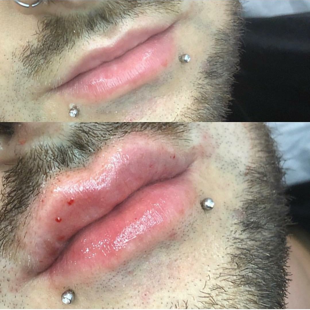 t_individualist's tweet photo. Sun-slay 🙌
Find dd aesthetics on The Individualist ❤️
.
#theindividualist #thehairandbeautyprofessionals #beauty #lipfiller #lips #beauty #hairandbeauty #leeds #lovingleeds #website https://t.co/sFdOs8iRAx