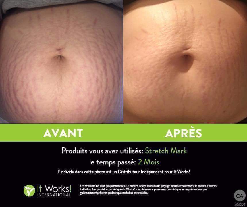 ItWorksPlants's tweet photo. Ais-je des femmes #enceintes dans mon twitter??

Quand nous sommes enceinte il est primordial de bien se #crèmer,  pour éviter les belles traces laisser par bébé. Bien sûr ce n'est pas inévitable pour chaque femme, par contre on peut toujours mettre les #chances de notre bord https://t.co/KwqW2R5dgs
