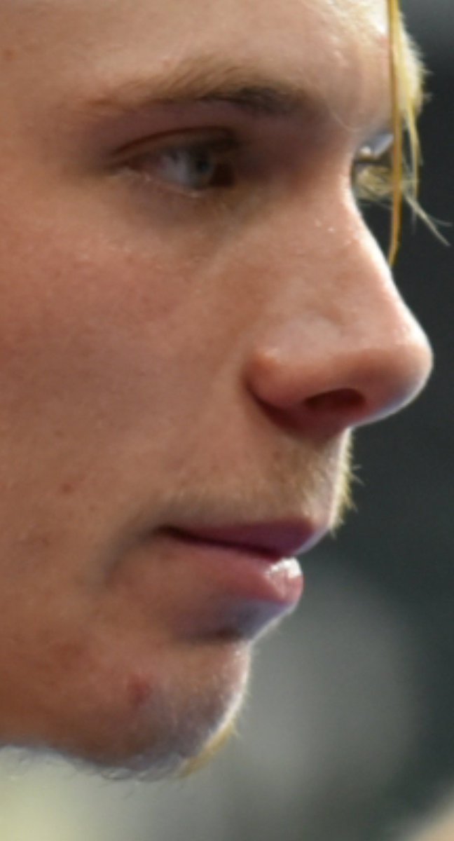 Ayumi デニス 金髪で目立たないけど結構お髭も伸びてます Actually He Has An Unshaven Face Ayumi デニス 金髪で目立たないけど結構お髭も伸びてます Actually He Has An Unshaven Face