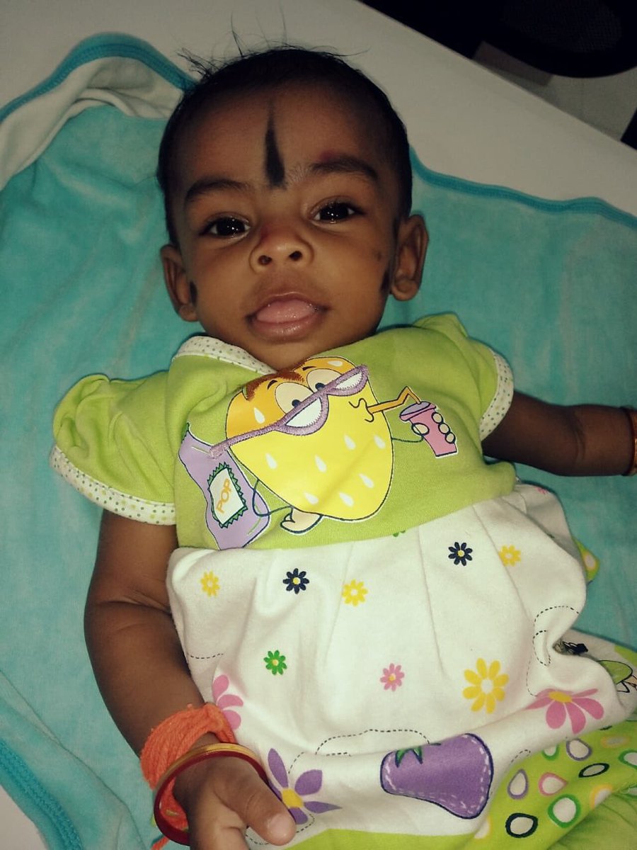 offl_Lawrence's tweet photo. Hi dear Friends and Fans..! She is Kavisri is a 7 months old baby and will be undergoing an open heart surgery, I need all your prayers.. https://t.co/fgbxH06dLB