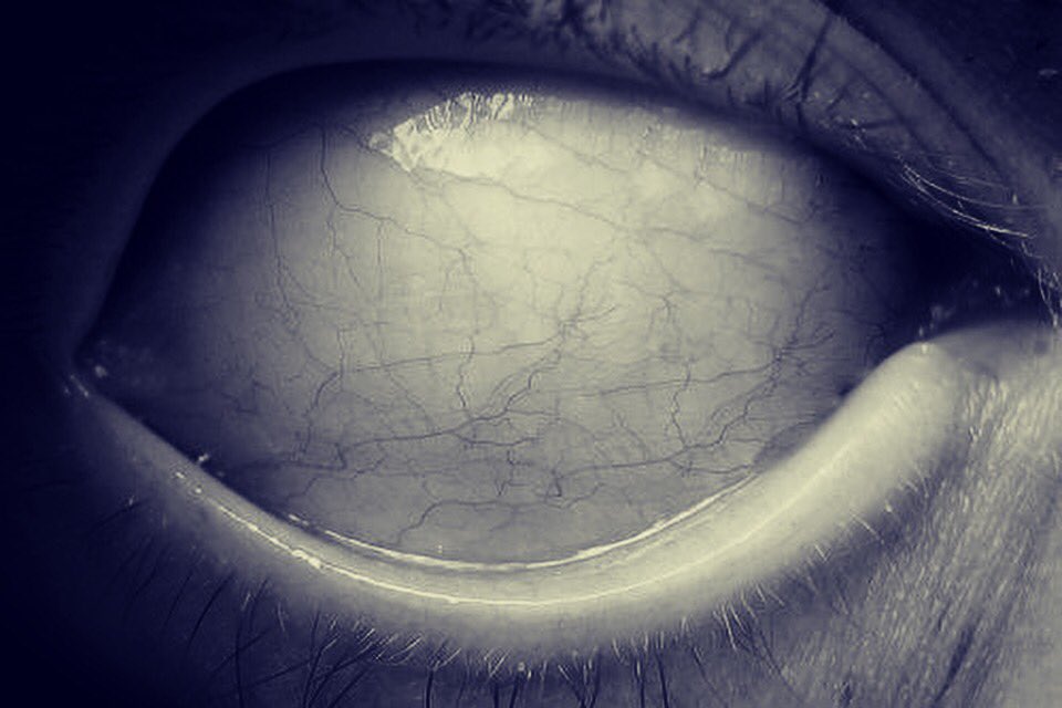 SalienceGas's tweet photo. The eyes can speak a thousand words. Even if they are soulless. Welcome To The Panic Room. #WelcomeToThePanicRoom #drumandbass #fear #soul #bloodshot #iphonephotography #eye #gaslighters #salience #questionyourself #look #where #all #your #darkest #fears #are #gonna #comeforyou https://t.co/S7Vrzj8SZ1