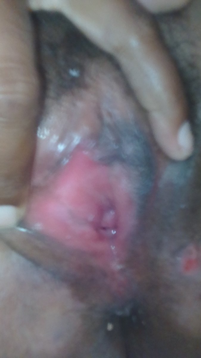 Gleangmailcom1's tweet photo. Asli bru hbs main bru fto https://t.co/3FJOEavAKJ