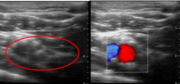 Stuart Grant tweet media