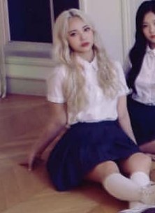 yeojines's tweet photo. e a Jinsoul com o braço quebrado volta a atacar https://t.co/a7KpSR6fW9