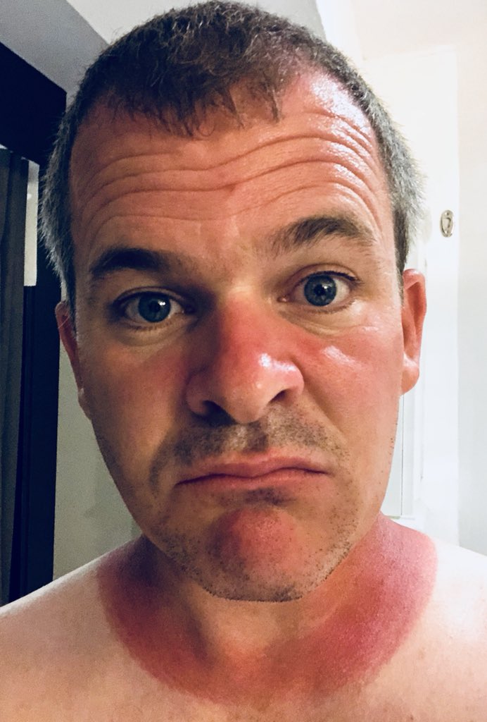 matthew0connor's tweet photo. I got lost on Mauritius today. I once was Irish but now my bust is from Hell. Or perhaps Luton, where the gammon is strong. #FreeTommy #FreeSunScreen https://t.co/xk91xHSecb