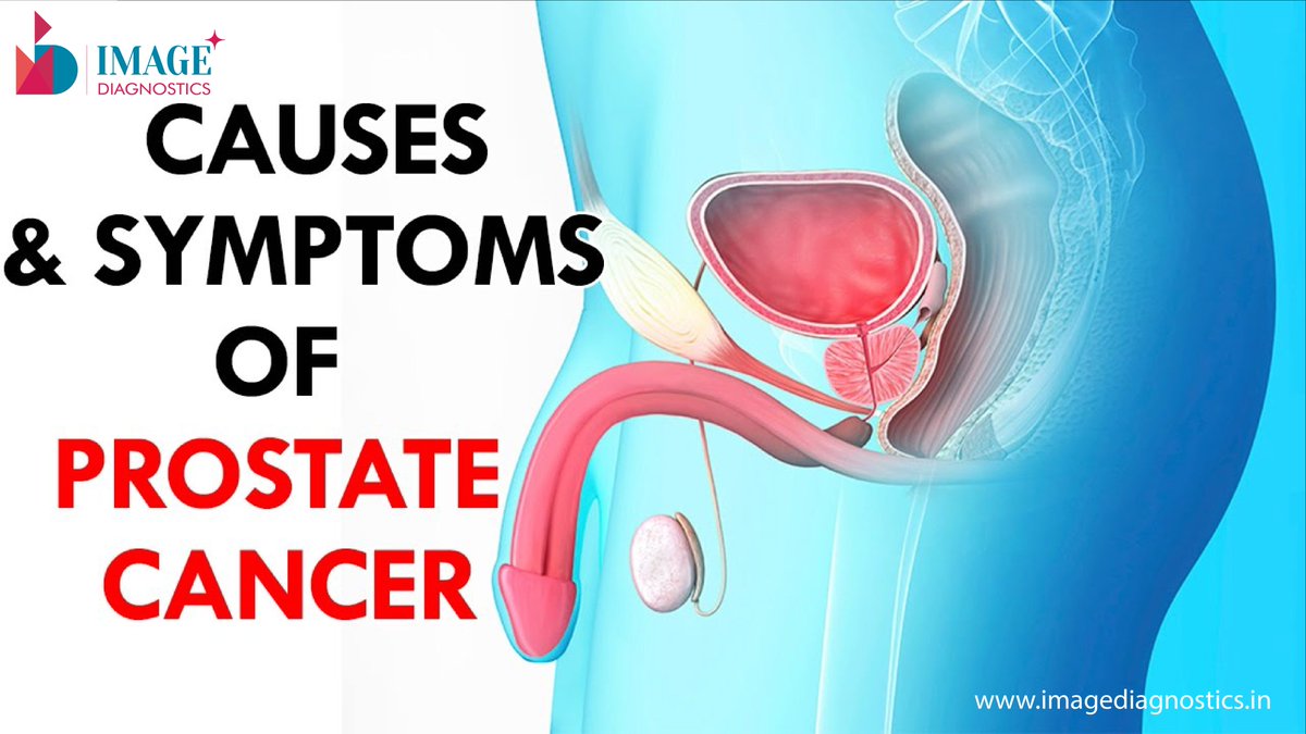 What are the Signs and Symptoms of Prostate Cancer?
Prostate cancer affects the prostate gland, the gland that produces some of the fluid in semen and plays a role in urine control in men.
Connect with Image Diagnostics
at imagediagnostics.in.
#prostatecancer #signsandsymptom