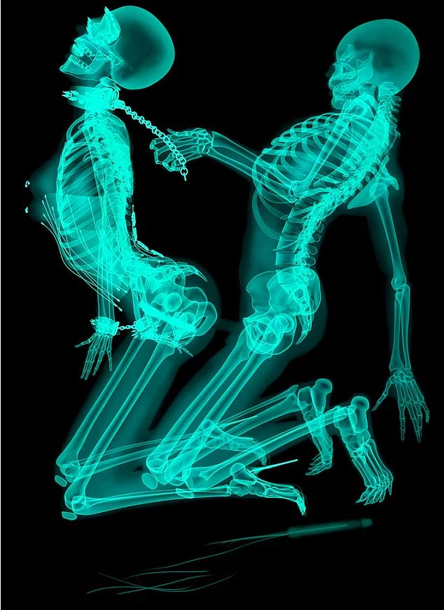 golie-pod-rentgenom-smotret-transov-s-ogromnim-chlenom
