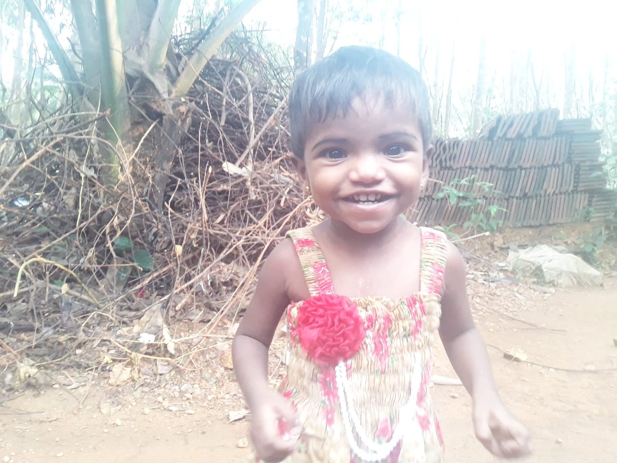 Ridha Fathima now 1 year old. She underwent TAPVC Repair when 6 months before at Amrita Institute.  #CHD #SaveLittleHearts <a href="/Genesisfndn/">Genesis Foundation</a>