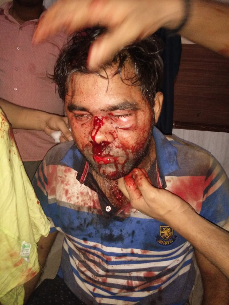 BaranwalHarsh's tweet photo. Doctors are not safe in India.
Where are human right activists? Where are all those spokespersons? Aren't we human? #MedicosUnsafeInBHU
@PMOIndia @narendramodi @RahulGandhi @JPNadda @ndtvindia @IndiaToday @PTI_News @RedCrossIndia 
@WHO @UNHumanRights https://t.co/yvGLOVEsju