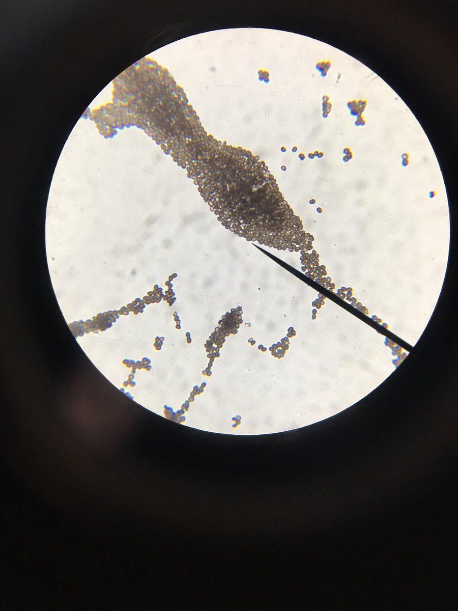 Year 10 Biology students studying Fungi, extracting spore prints from Mushrooms and viewing the spores under the microscope #biology #science #diadubai <a href="/DIA_Secondary/">Secondary | DIA Emirates Hills</a>