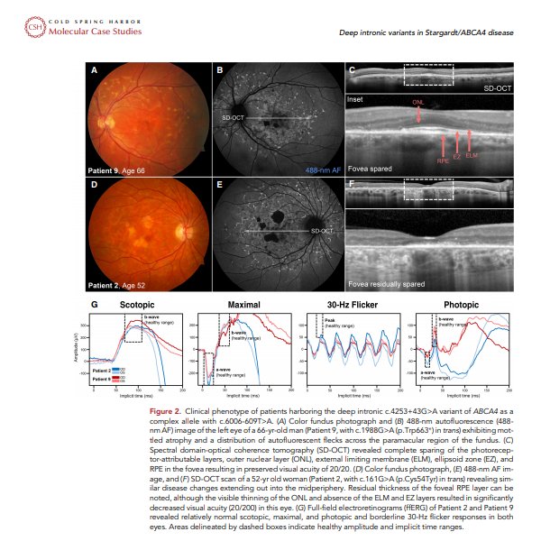 Science_Open's tweet photo. ‘Extremely #hypomorphic and severe deep #intronic variants in the  ABCA4  locus result in varying #Stargardt disease #phenotypes’, an #openaccess article in the #ScienceOpen collection ‘#Molecular Case Studies’ @molcasestud by Cold Spring Harbor: 
https://t.co/csf1mY7f3q https://t.co/pwivbu6p9w
