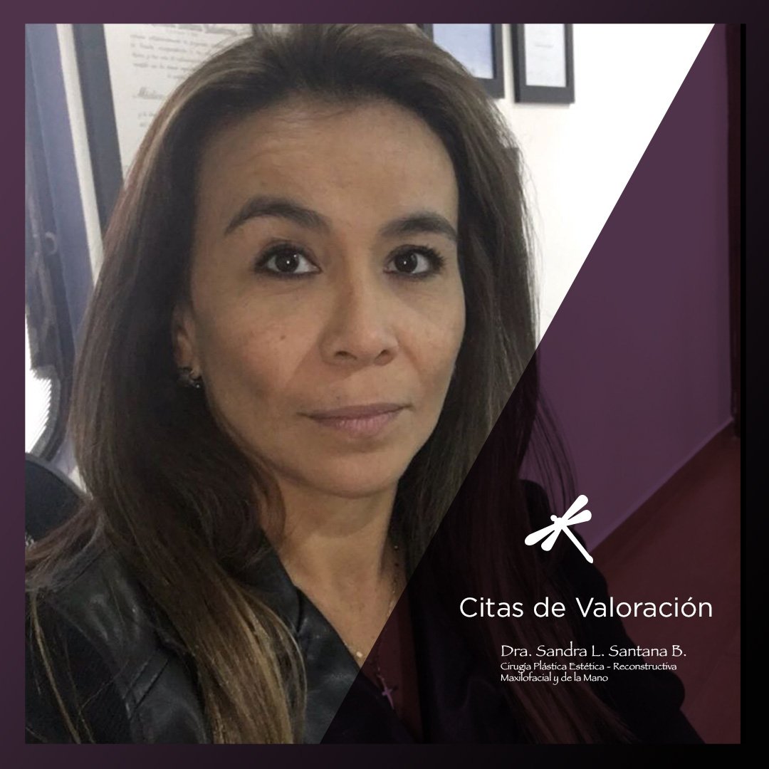 sandrasantanaCP's tweet photo. ¿Ya programaste tu cita de valoración? 💜 Citas: 3124874182 - Bogotá 🌎 https://t.co/tgiQ2ak3fv #DraSandraSantana #cirugiaplastica #cirugiaplasticabogota #cirugiaplasticacolombia #cirugiaplasticasegura #sccp #isaps #ipras #filacp https://t.co/xUX6oiAN7a