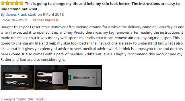 xpreenofficial's tweet image. We appreciate our customer's review deeply which shares the picture and feelings of mole remover.If you wish to get rid of mole tattoo spot remover, Xpreen is your best choice.@xpreenofficial 
#xpreen #beauty  #customerexperience  #skincare  #mole