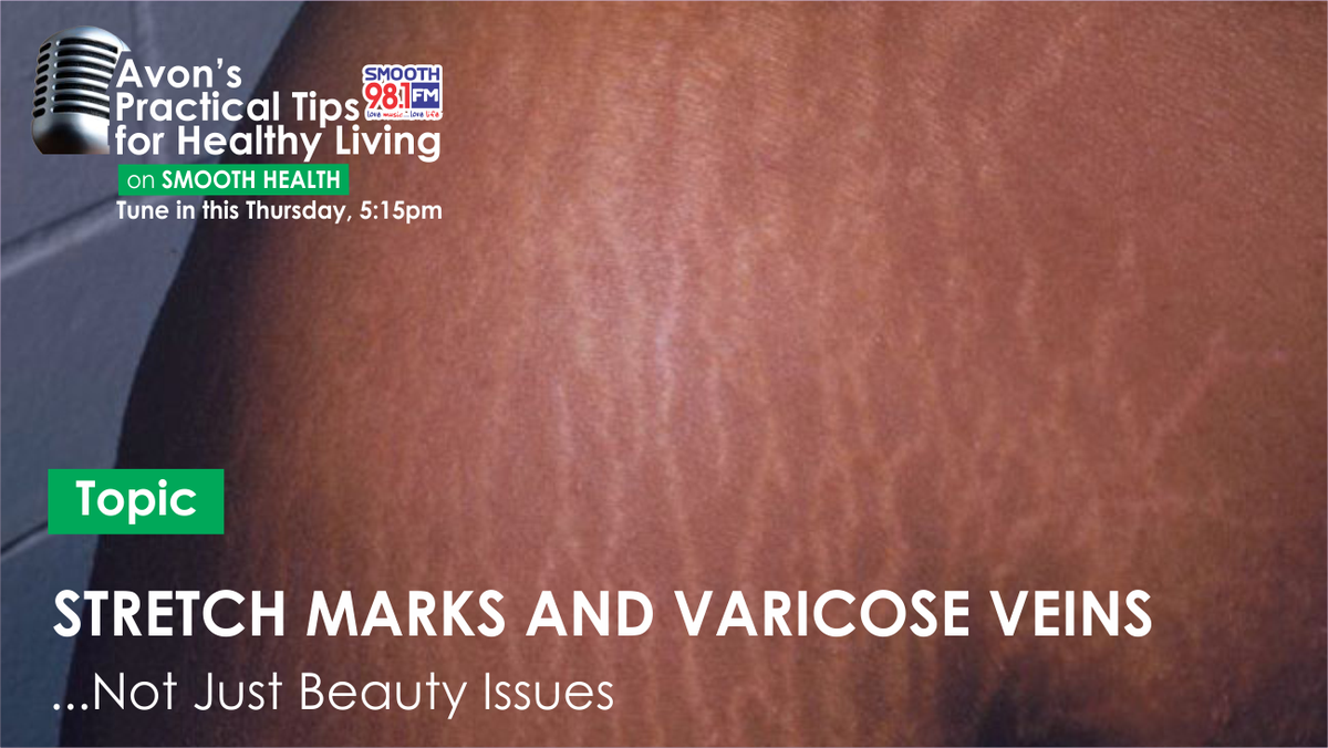 AVONHMO's tweet photo. Have questions about: Stretch marks and Varicose veins? Leave a comment, send a DM or email us. 
#SmoothHealth #AvonHMO #Radioshow #Smooth981FM #Practicaltips #AvonPracticalTipsForHealthyLiving https://t.co/w49xfvoPYw