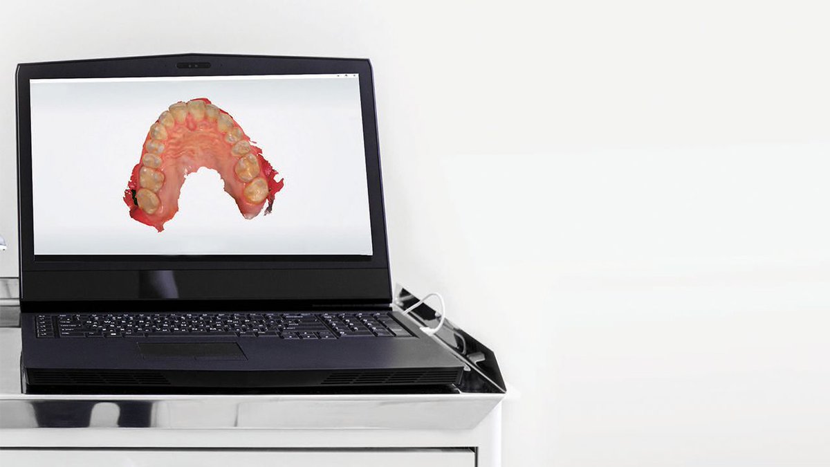 An evidence-based evaluation of three-dimensional scanning technology in orthodontic practice.
decisionsindentistry.com/article/intrao…
#Clear #Invisalign #Intraoral #Scanning #3D #Digital #Technology #Orthodontics