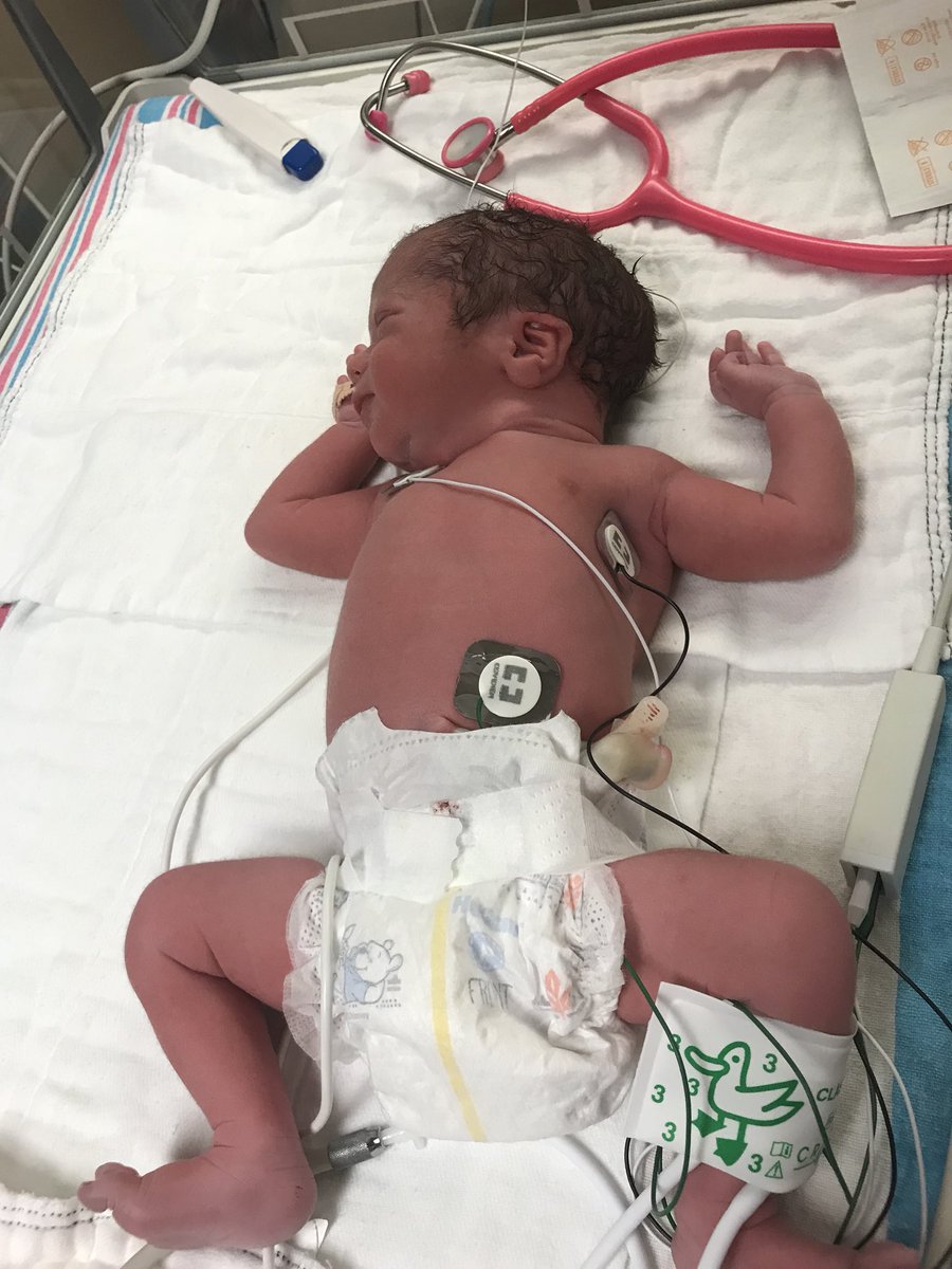 CoachKirby25's tweet image. Everett and Jackson Kirby are here and doing good! Rachel was a rockstar and is resting! Very exciting times and continued prayers are appreciated!