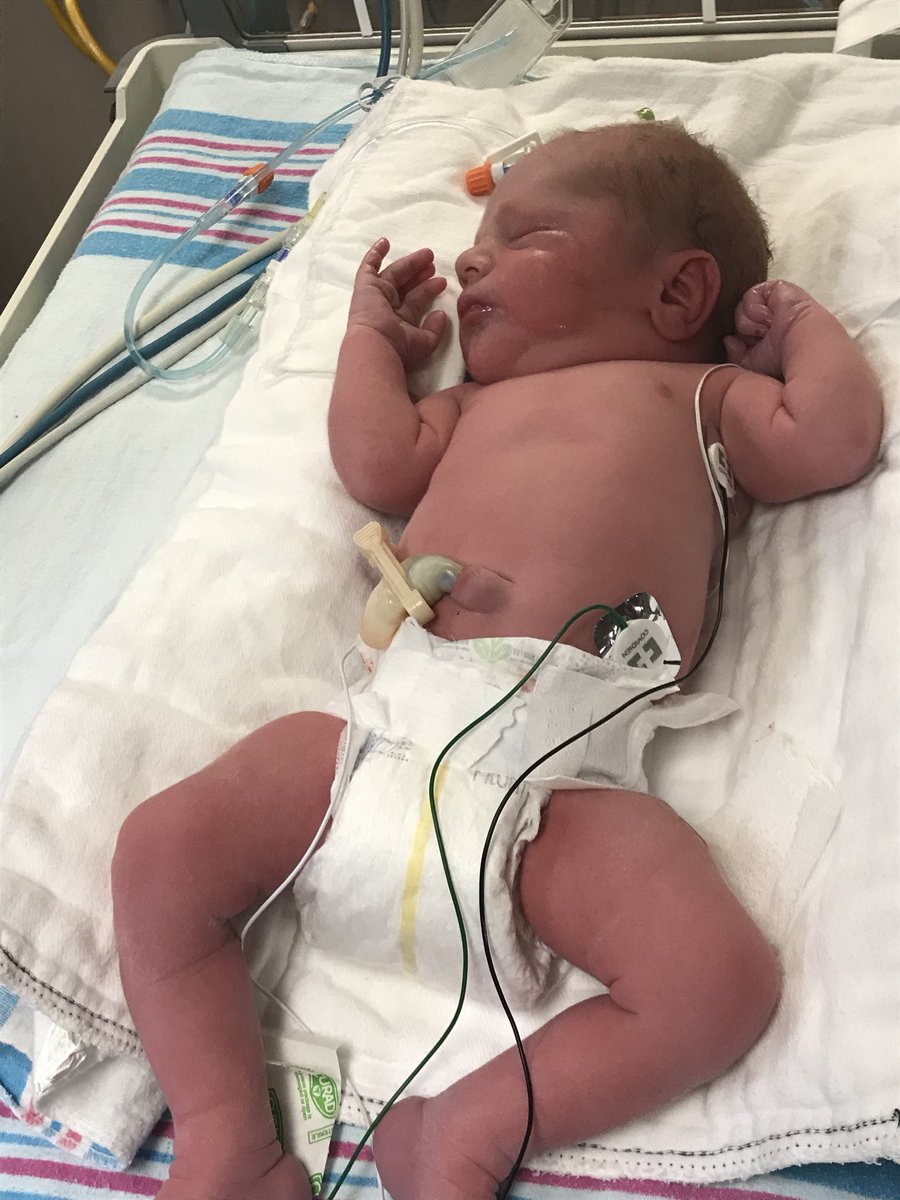 CoachKirby25's tweet image. Everett and Jackson Kirby are here and doing good! Rachel was a rockstar and is resting! Very exciting times and continued prayers are appreciated!