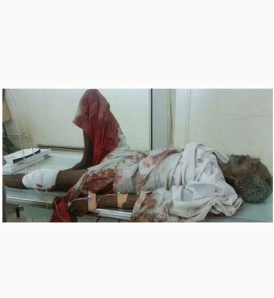 RealRameyDawoud's tweet photo. 5 years ago this happened to my uncle. Read description in last photo. #Sudan #NISS https://t.co/DbBjEPGt5e