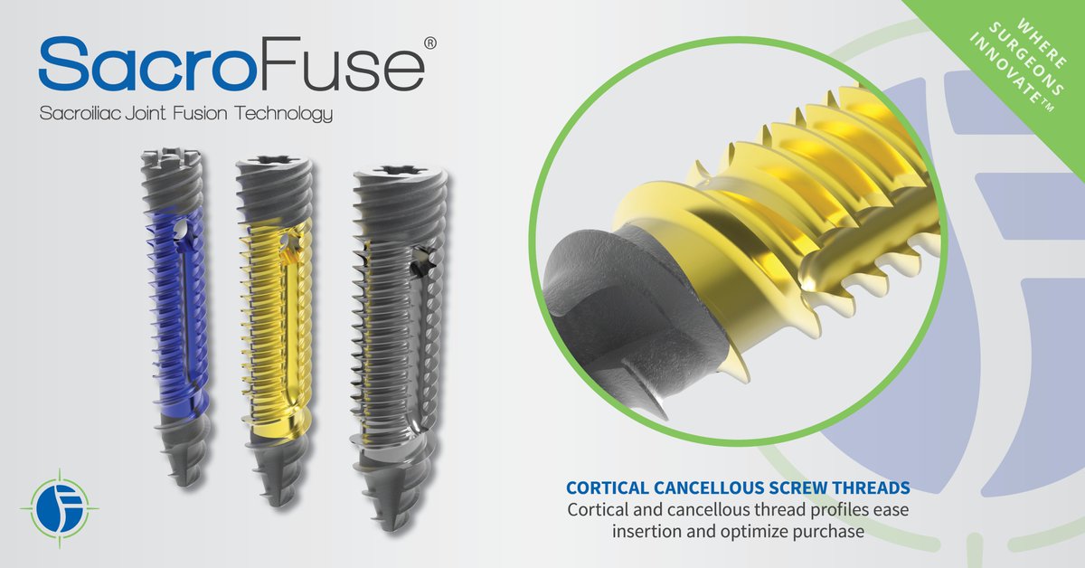 SpineFrontier's tweet photo. Why SacroFuse? Check us out at #NASS booth #2429 today to discover the innovation behind our sacroiliac joint #fusion technology - and explore hands on demos of our #LessExposureSurgery products. #kicventures #NASS18 #NASS2018 #LES #MIS #minimallyinvasive #orthopedics #spine https://t.co/0LvU13kyMz