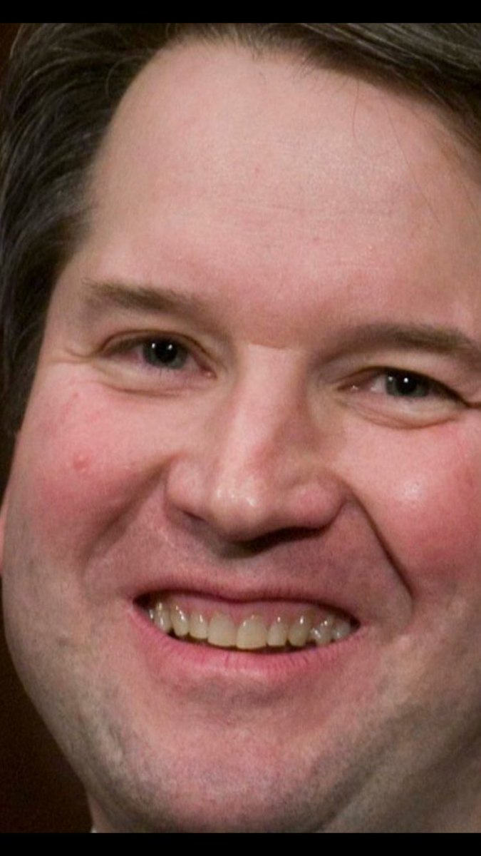 mlbanner's tweet photo. Anyone with crypt keeper teeth would probably have to force themselves on someone. This dude is disgusting. #Kavanaugh #bustedgrill #fixyourteef #KavanaughCircus https://t.co/PDbl8y7NoV