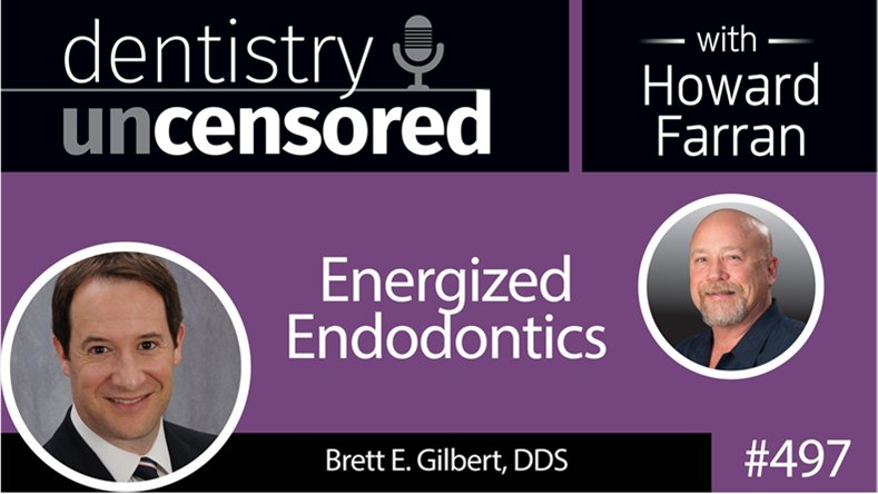 Energized Endodontics with Dr. Brett E. Gilbert DDS, Diplomate American Board of Endodontics youtu.be/e4DUpkW0T-k @bgilbertdds 
<a href="/kingendodontics/">King Endodontics</a>
