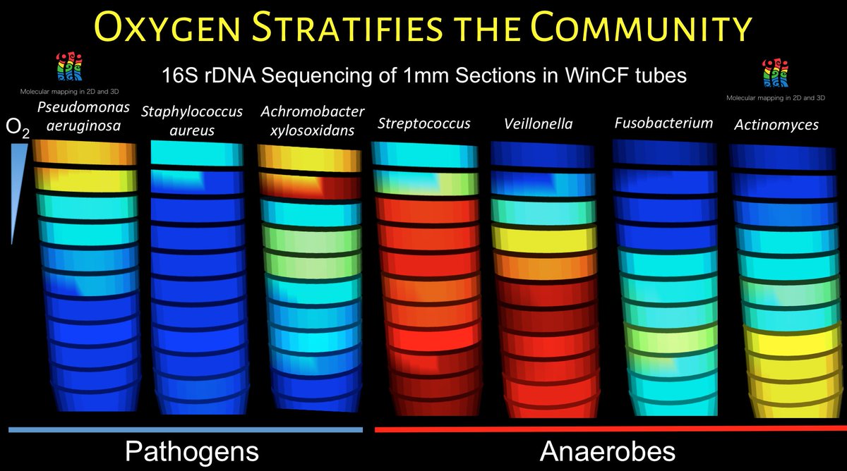 UCSDHealthSci's tweet photo. #CysticFibrosis patient sputum + unique lung model reveal insights into microbial communities that plague CF patients and how they might best be treated https://t.co/40xPSqrpMy #PrecisionMedicine #microbiome 

@ScienceAdvances @Pdorrestein1 @quinn_rob @CMIdigest @UCSDSkaggsSOP https://t.co/eoX3MsEGyM