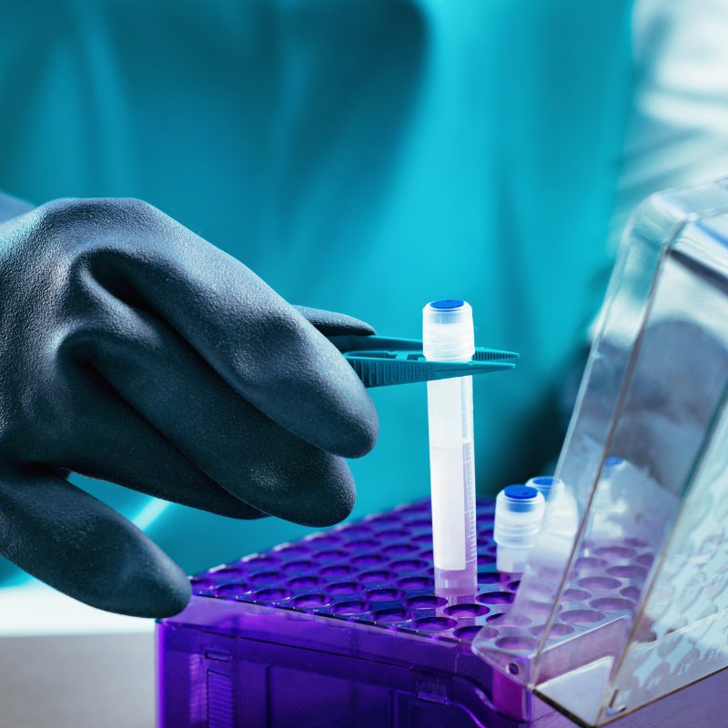 surgenex's tweet photo. Will an amniotic membrane and its stem cells preserve their capacity after cryopreservation? Read about it here https://t.co/xYkmNRuDhT
.
.
.
.
.
.
#surgenex #medicine #study #research #biotechnology #science https://t.co/O682wmN1J9