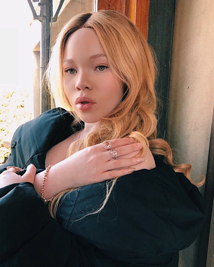#TheQueenMzansi
Ppl with Albinism are normal like every1 else. They have fears, worries, problems, gratitude, compassion, love, humility, feelings & ambitions lyk all of us.
Dey are equally worthy of respect, love, a safe society and happiness.
Thankx 4 the Education.
#Botho