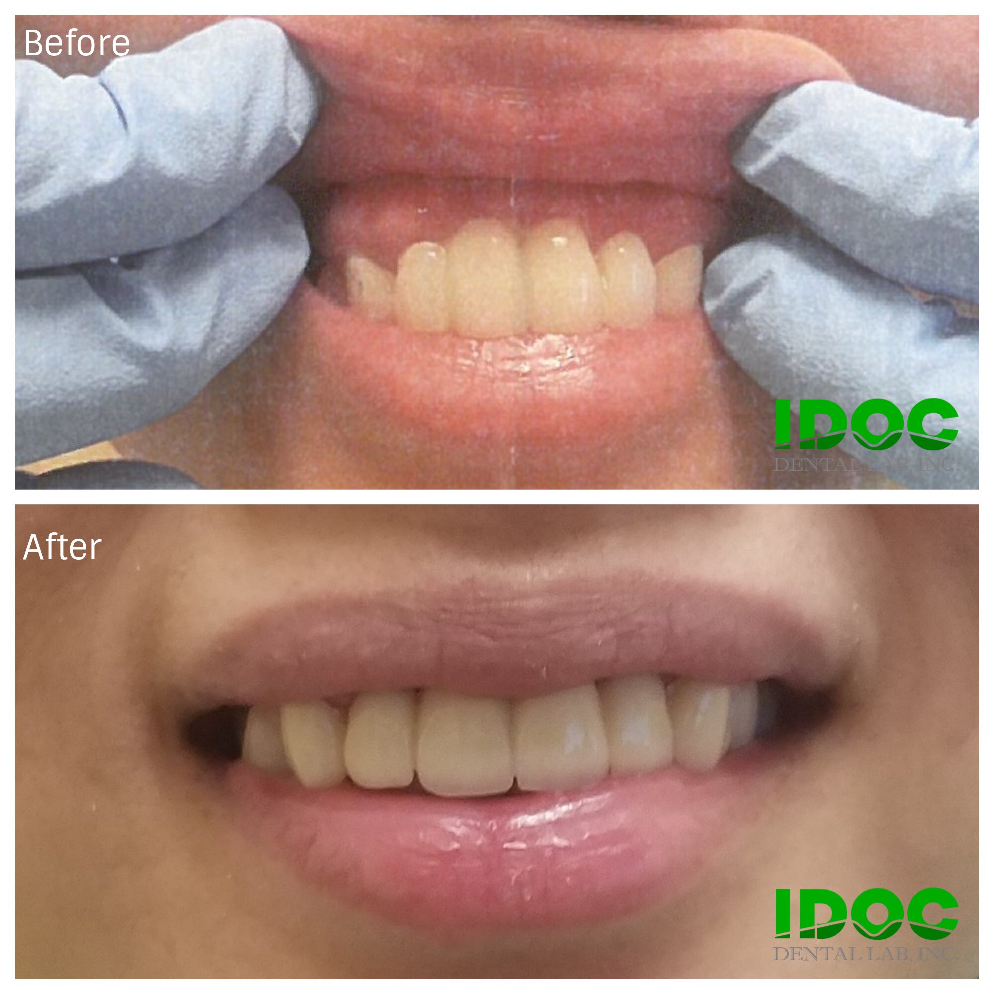 IDOC Dental Lab (IDOCdentalLab) / Twitter
