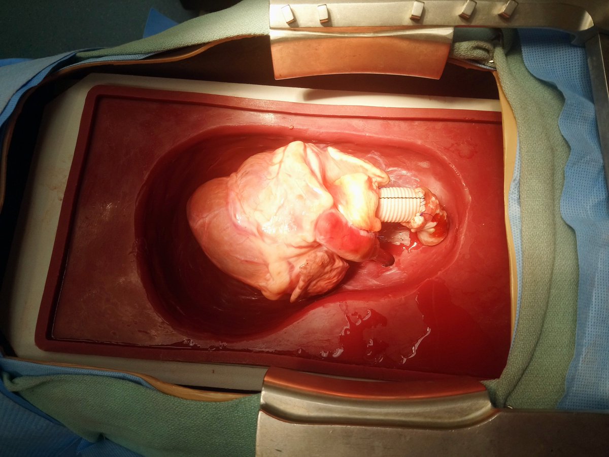 Collecting first aortic anastomosis data on a heart simulator. :)