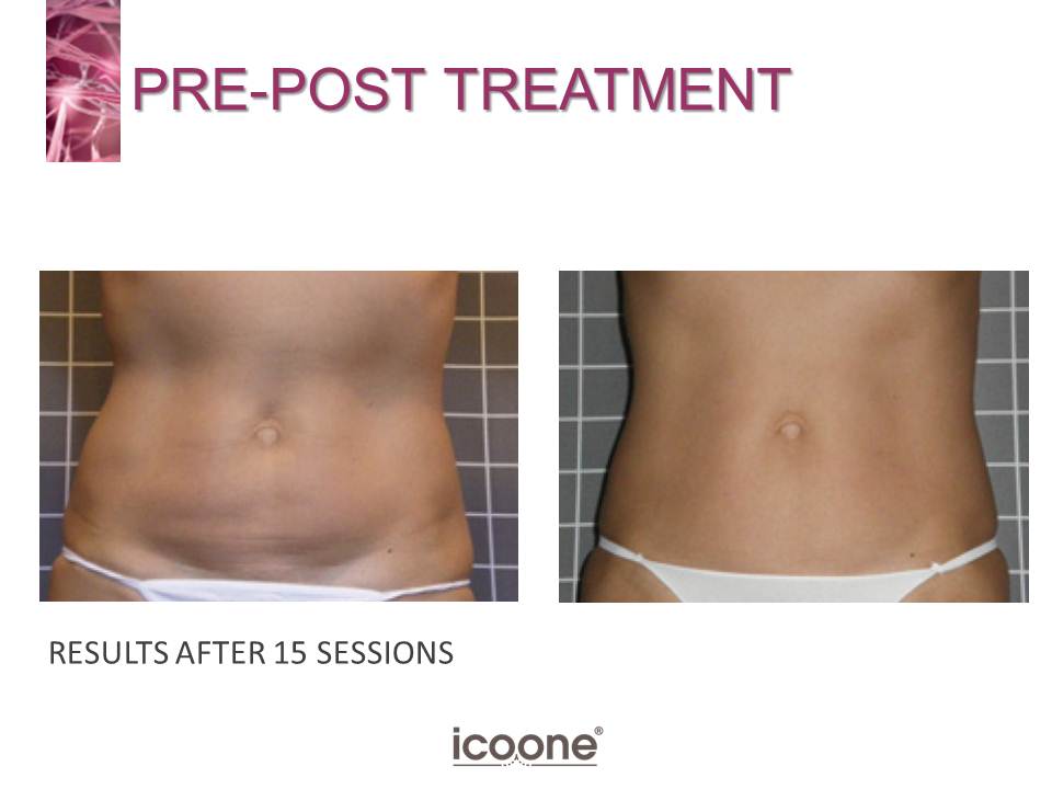 bellashapeusa's tweet photo. Bella Shape stimulates the reduction of fat cells, because it activates their natural metabolism. Fat becomes a thing of the past.
. 
.
#beauty #health #wellness #skincare #beautiful #bellashape #bocaraton #youthful #glowup #skin #bodyshaping #workout #glowing #bodycontouring https://t.co/5dQmYBikh1