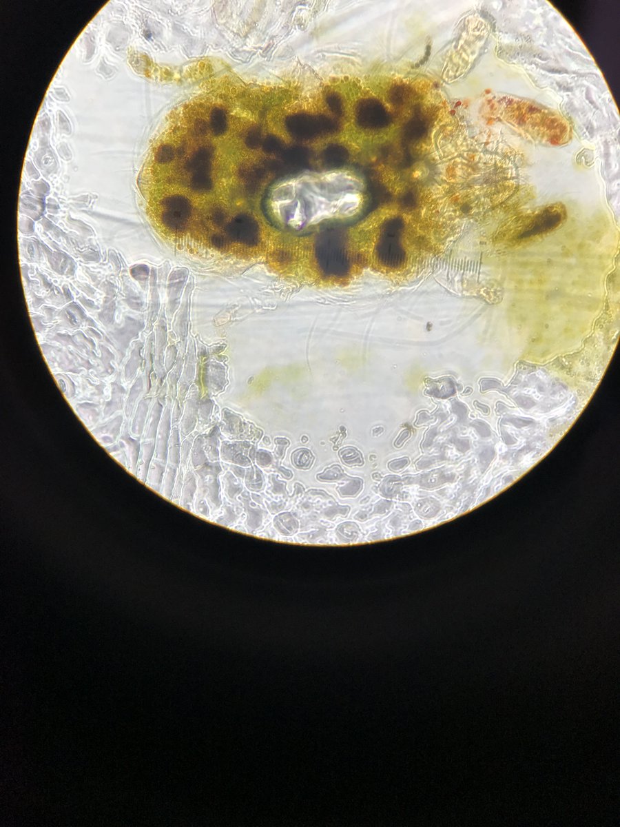 clara_laplume's tweet image. While looking at tree leaf stomata imprints, made from nail polish and clear tape, I found this tiny little insect. Image at 400x magnification. Is it a mite? #KSCBio #PhyteClub #entomology
