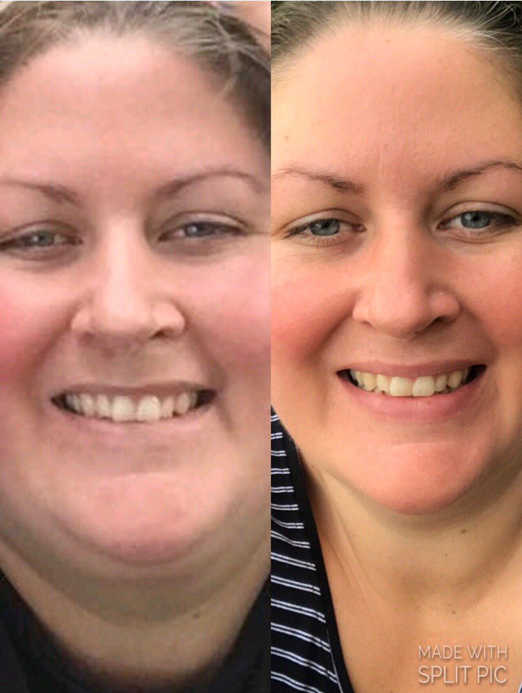 chattycandace's tweet photo. #weightloss. Check out Your 12in24 Coffee Store &amp; More Facebook page for my whole story https://t.co/HpBuutfgeG