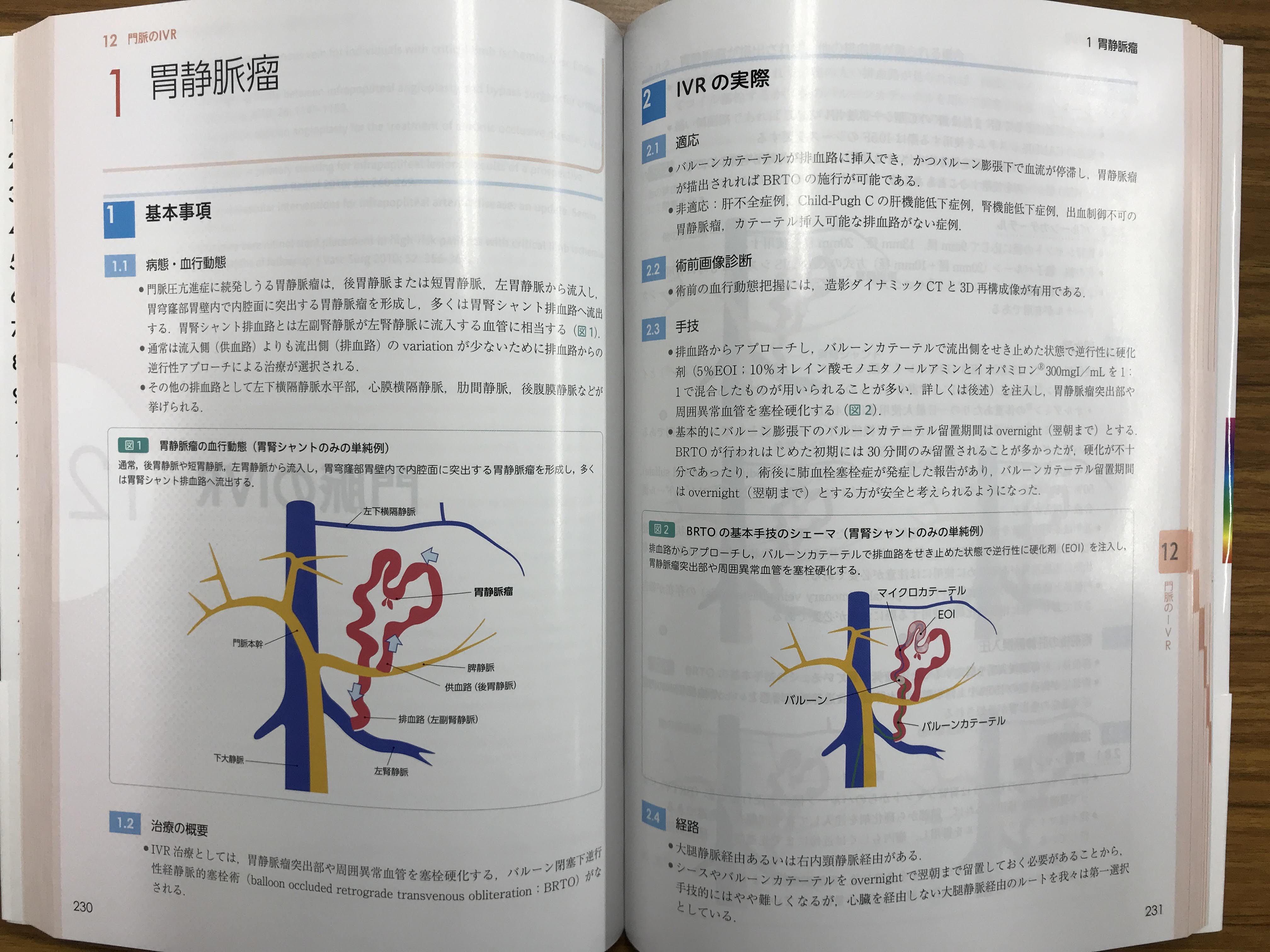 皆伝! IVRの知恵 [単行本（ソフトカバー）] 佐藤守男; 河合信行