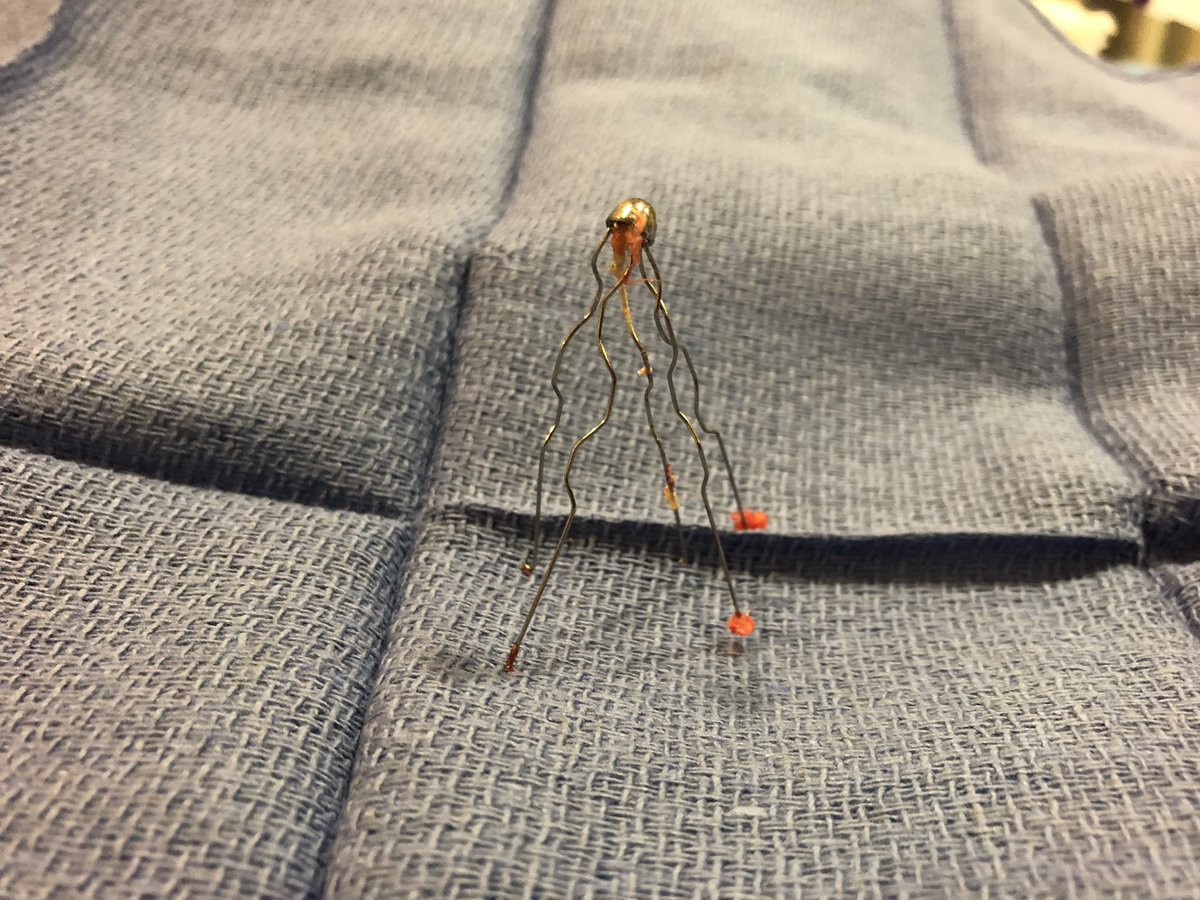kush_r_desai's tweet photo. One last #filterOUT before @SIRspecialists #ACTiVE18! 29 year old, migrated, fractured Kim-Ray Greenfield. Excited for more VTE goodness tomorrow! @rkryu @jameshorowitzmd @akhileshsistaMD @JonnyMoriarty @rustyhofmannMD https://t.co/xwdjpNLwaT