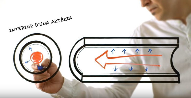 Un 68,7% de les 7.481 persones que s’han visitat a <a href="/elbusdelasalut/">El Bus de la Salut</a>  presentaven, en major o menor grau, malaltia ateromatosa, és a dir, disminució del calibre de les artèries per l’acumulació de plaques de greix a les seves parets.
#prevenciocardiovascular
#prevenciorenal
