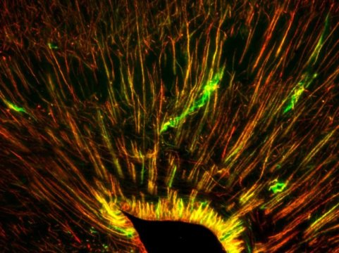 WoundCare_2019's tweet photo. #Leopard_geckos can make new #brain_cells.
For more information please visit: https://t.co/Vyl7iIpbHM https://t.co/CxVJAspZEX