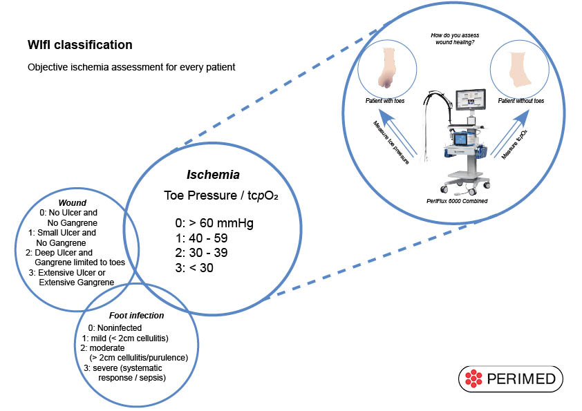 perimedgroup's tweet photo. Last chance today to meet us @ESVSmembership Annual Meeting in Valencia. Come by our booth to find out how we can help you with #PADdiagnosis and #CLTI assessment. #ESVS2018 #toepressure https://t.co/Zx8y2aBwg5